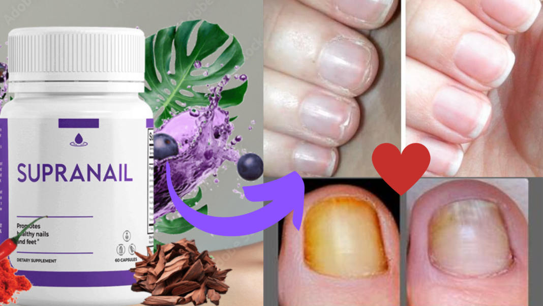 Supranail Fungus Treatment