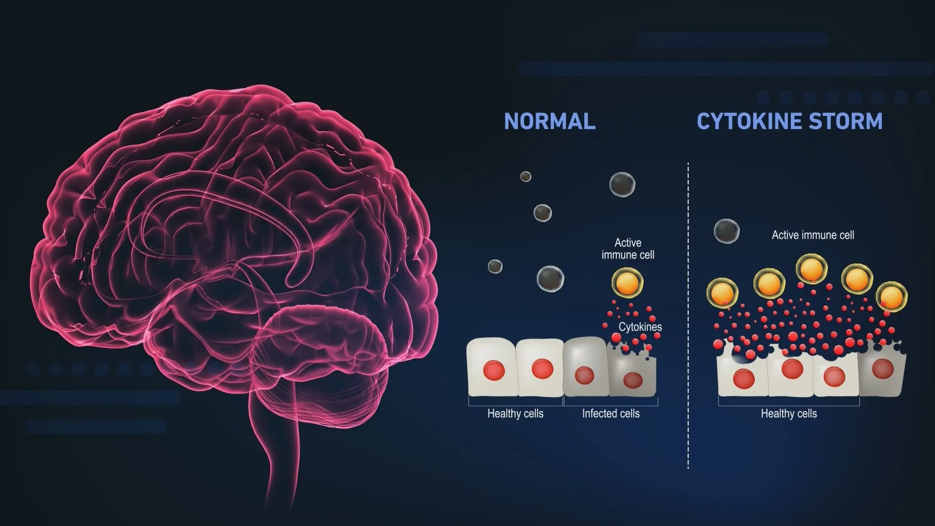 The Unbreakable Brain