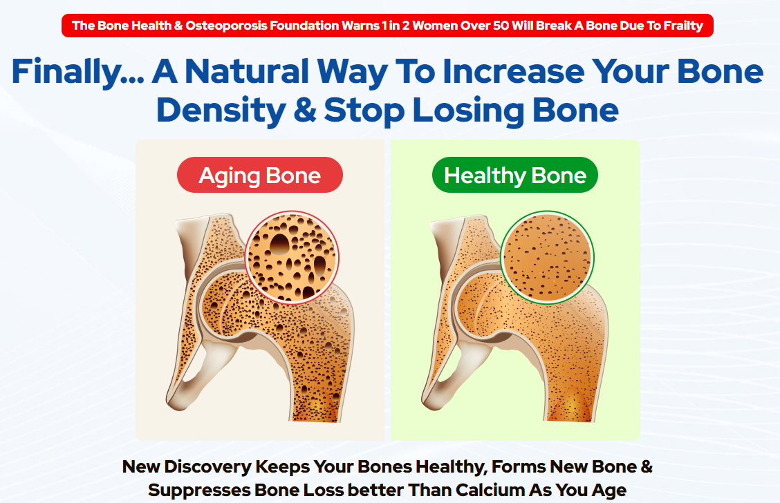Biocal Bone Support