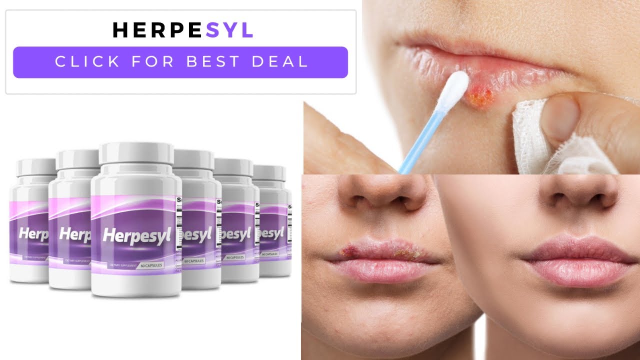 Herpesyl Herpes Solution
