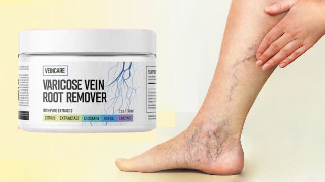 Veincare Varicose Vein Root Remover